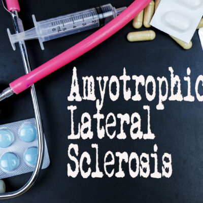 How Your Diet Can Impact Stem Cell Treatment for ALS