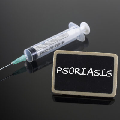 The Worst Foods For Psoriasis And Treatment Options