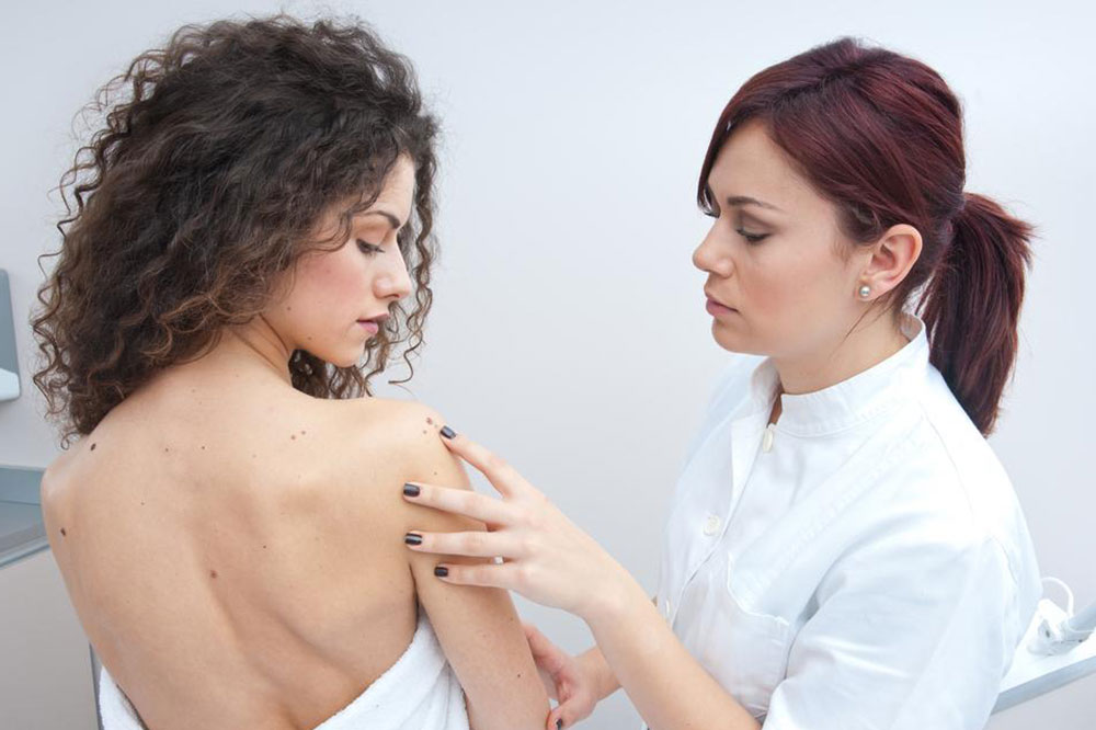 Symptoms, Prevention, and Treatment for Melanoma
