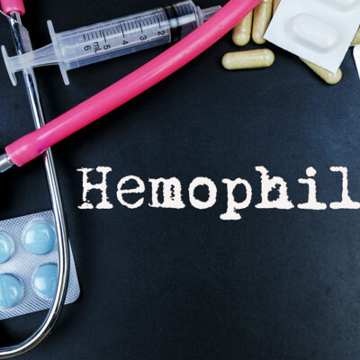 Symptoms and Treatment Options for Hemophilia