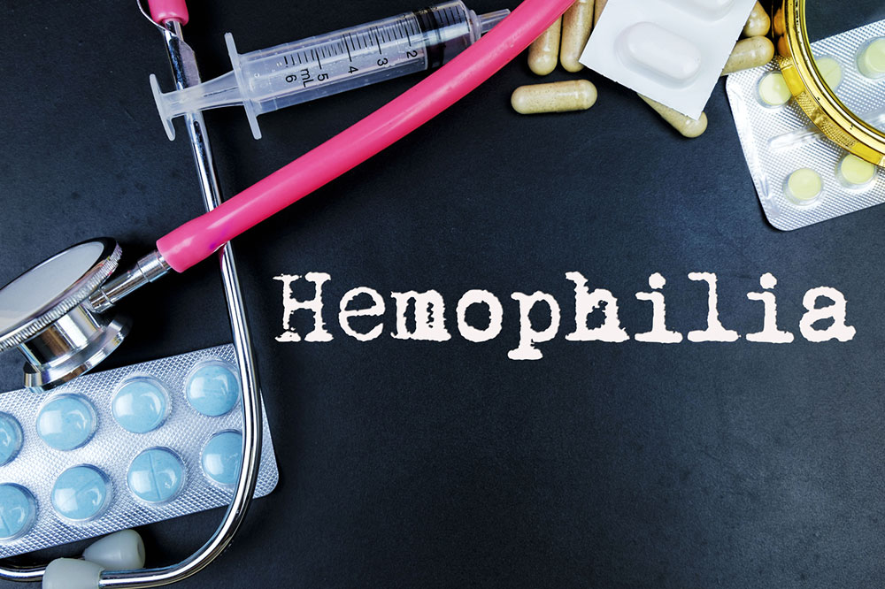 Symptoms and Treatment Options for Hemophilia